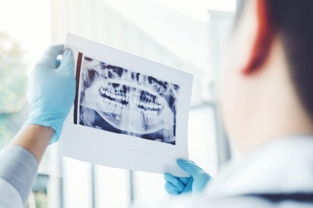 routine dental x-rays with preventative dentistry